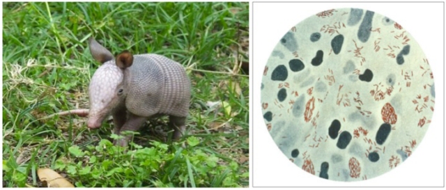Armadillo and Mycobacterium leprae, 8 Cuddly Creatures and the Dark, Deadly Diseases They Carry 